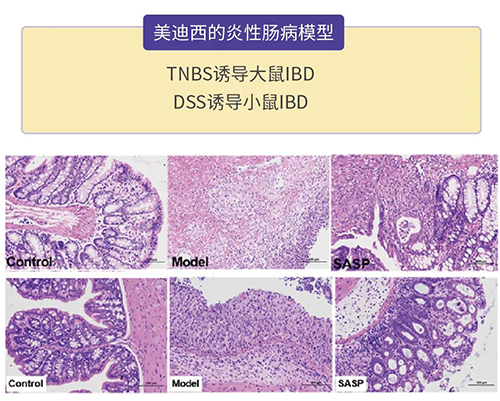 pp电子的炎症性肠病模型