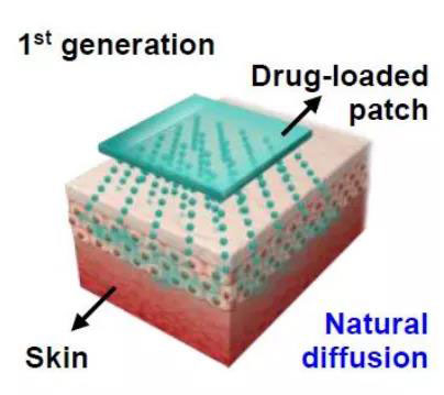 第一代透皮给药技术：通过药物的自然扩散.jpg